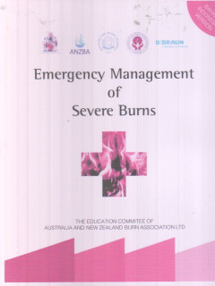 Emergency Management Of Severe Burns