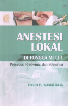 Anestesi Lokal Di Rongga Mulut: Prosedur, Problema, Dan Solusinya