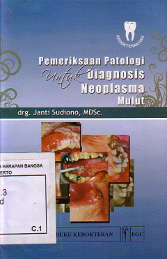 Pemeriksaan Patologi Untuk Diagnosis Neoplasma Mulut