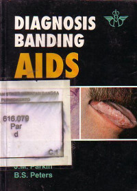 Diagnosis Banding AIDS