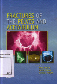 Fractures Of The Pelvis And Acetabulum