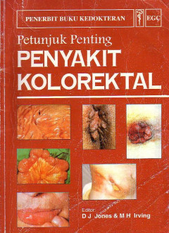 Petunjuk Penting Penyakit Kolorektal