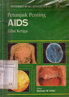 Petunjuk Penting AIDS