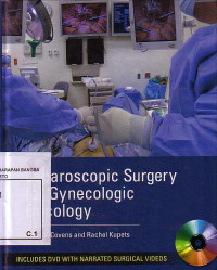 Laparoscopic Surgery For Gynecologic Oncology