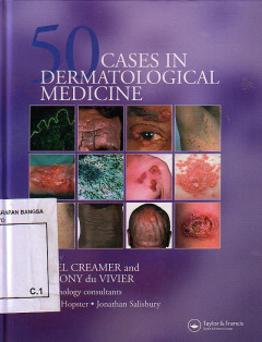 50 Cases In Dermatological Medicine