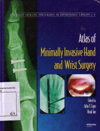 Atlas Of Minimally Invasive Hand And Wrist Surgery