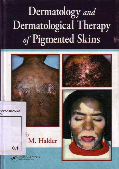 Dermatology And Dermatological Therapy Of Pigmented Skins