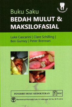 Buku Saku Bedah Mulut Dan Maksilofasial