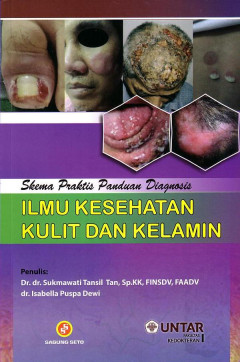 Skema Praktis Panduan Diagnosis: Ilmu Kesehatan Kulit Dan Kelamin