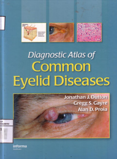 Diagnostic Atlas Of Common Eyelid Diseases