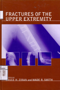 Fractures Of The Upper Extremity