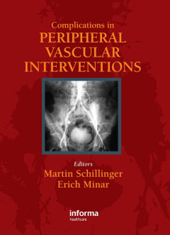 Complications in Peripheral Vascular Interventions