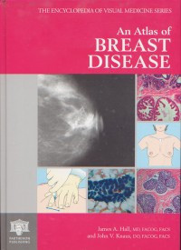 The Encyclopedia of Visual Medicine Series : An Atlas of Breast Disease